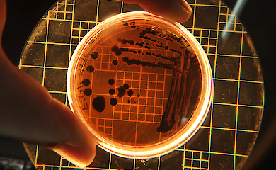 Мікроорганізми, здатні виживати в екстремальних умовах, під мікроскопом