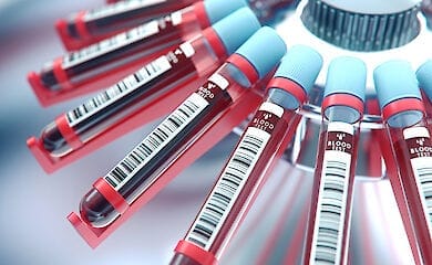 Предупредить смерть от сердечных болезней станет возможным с помощью простого анализа