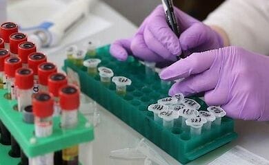 Стало известно, кто в серьезной зоне риска на заражение коронавирусом