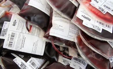 Напряженное эпидемическое состояние усугубляет ситуацию с заготовкой донорской крови, - КМДА
