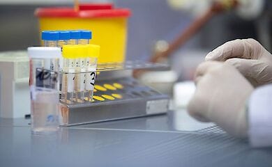 Академія наук України готує тест-системи COVID-2019